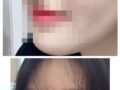 제 코 자랑하러왔슴다 :D