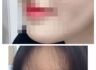 제 코 자랑하러왔슴다 :D